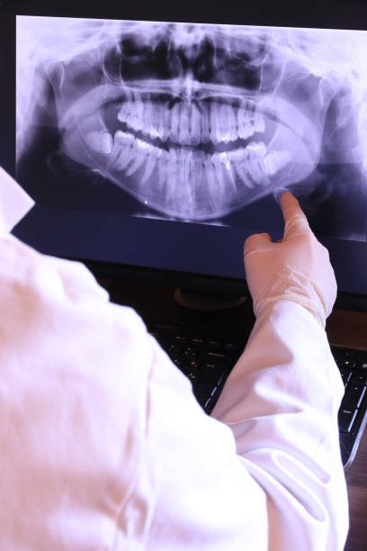Best Emergency Treatment for Oral Infections in Yuipa, CA