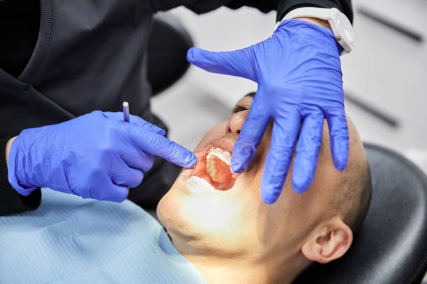 Best Walk-In Emergency Dental Services in Yuipa, CA